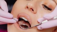 zuby dentist-8662291 1280